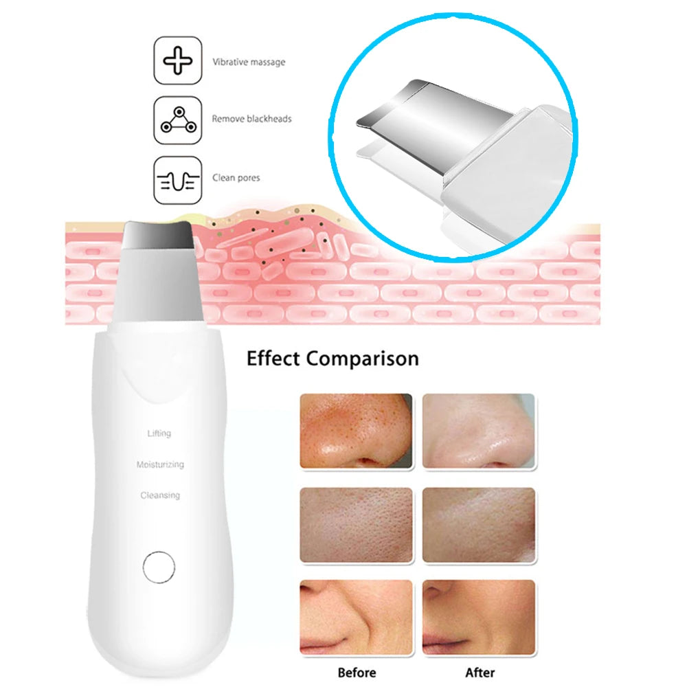 Blackhead Remover Scrubber