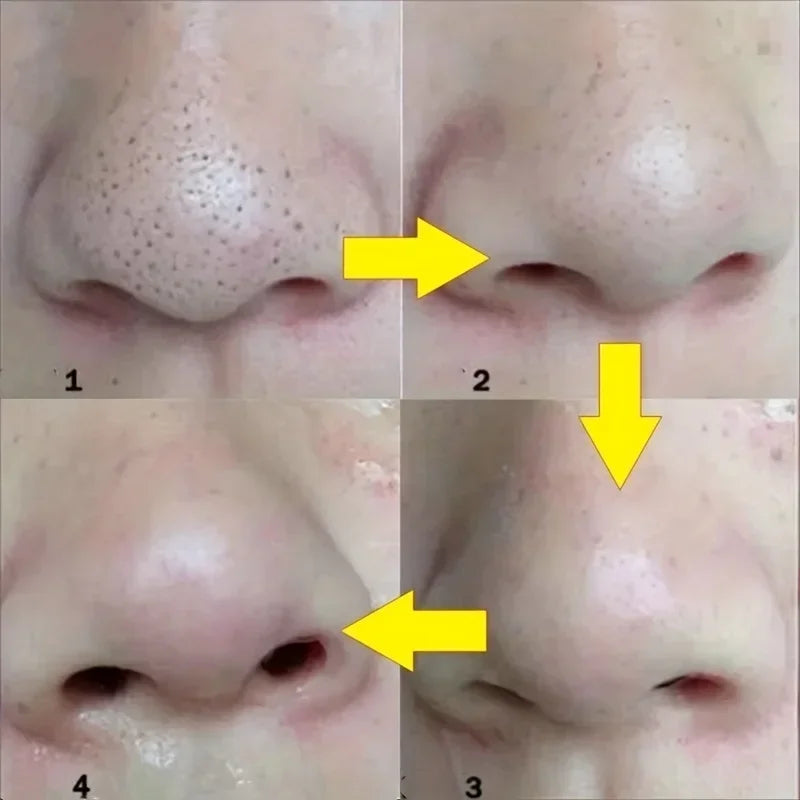 Deep Cleansing Nose Strips