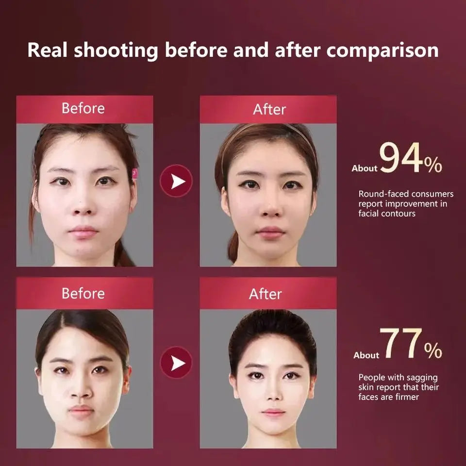 LED Facial Lifting Device