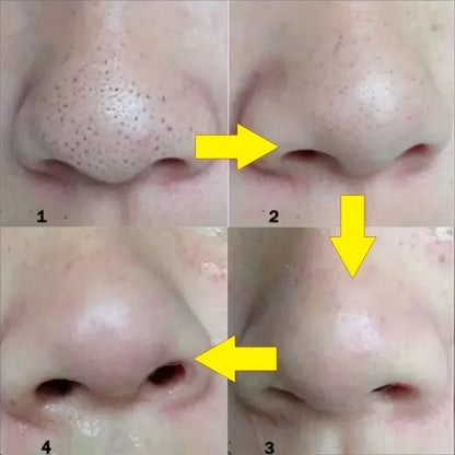 Deep Cleansing Nose Strips