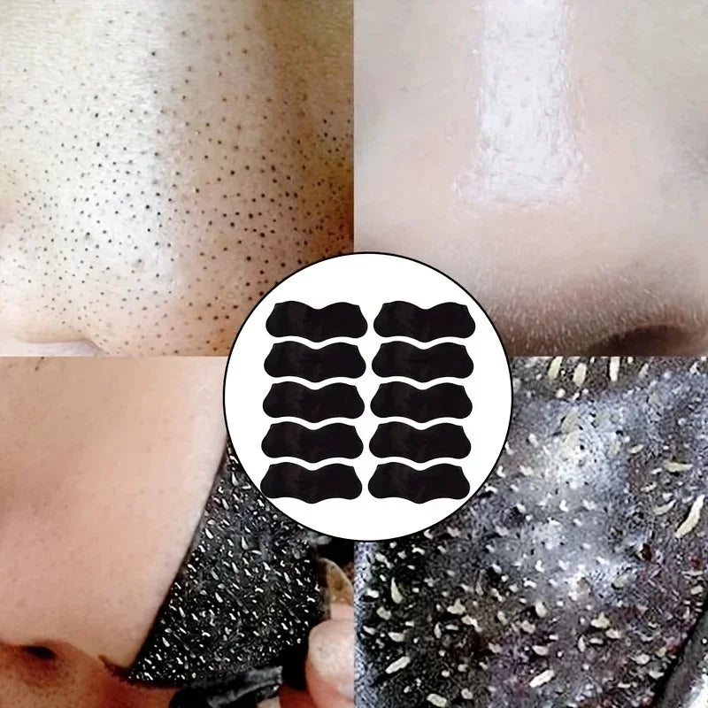 Deep Cleansing Nose Strips