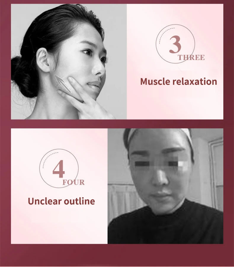 LED Facial Lifting Device