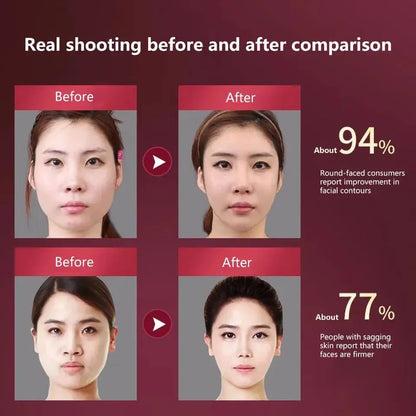 LED Facial Lifting Device