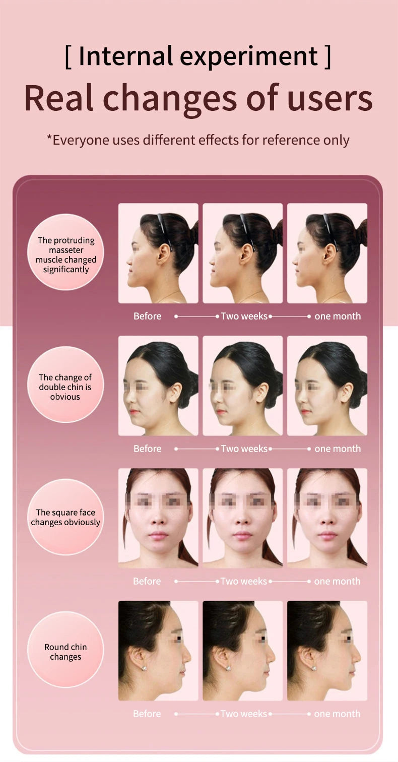 LED Facial Lifting Device
