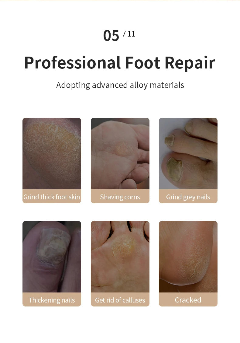 Automatic Foot Care Device